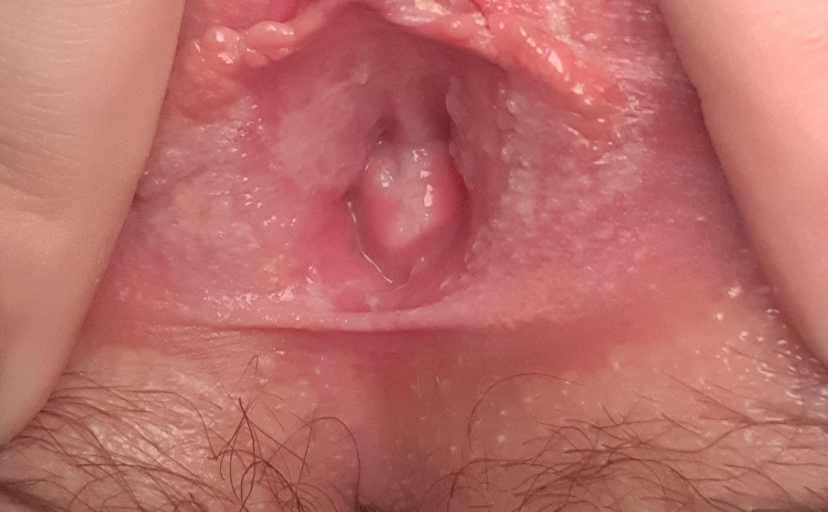 может ли сперма с половых губ попасть во влагалище фото 33
